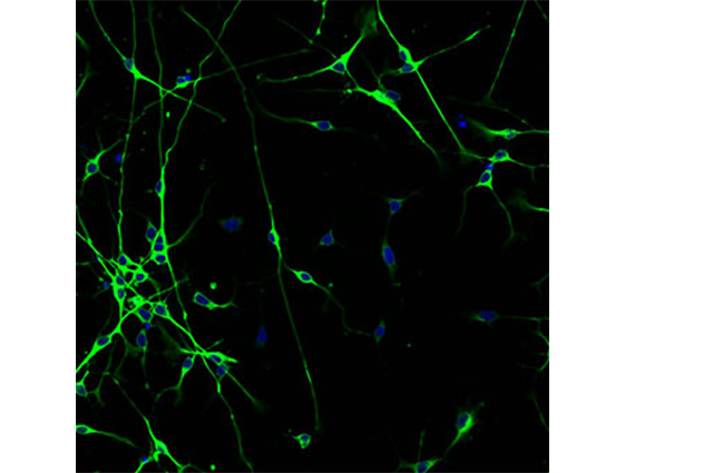Cortical neurons stained for Beta-Tubulin (green) and DAPI (blue)